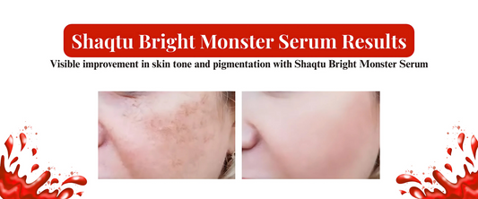 Reduce Dark Spots & Pigmentation Effectively