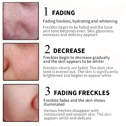 Brightening Retinol serum by Shaqtu