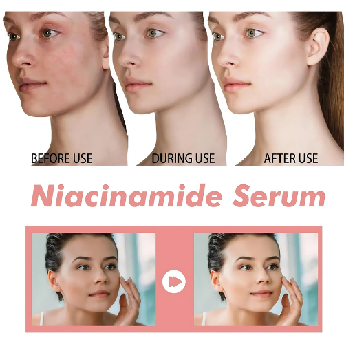 Niacinamide serum packaging image